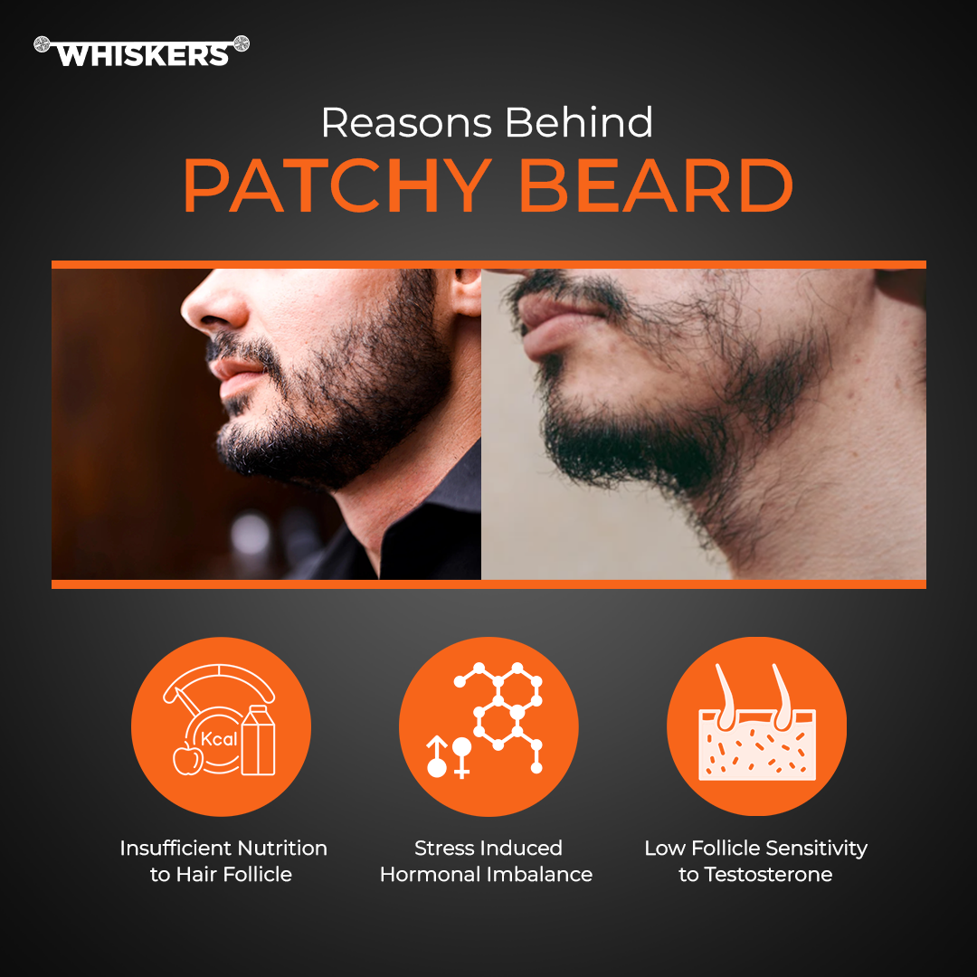 Power Beard Oil For Patchy & Uneven Beard Nourishes for Longer and Thicker Beard Hair